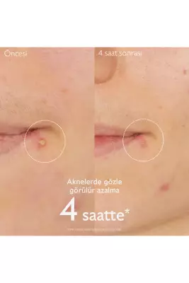 Caudalie Vinopure Düzensiz Ciltler 15 ML Salisilik Krem - 3
