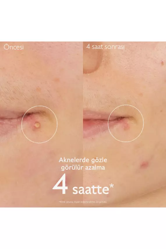 Caudalie Vinopure Düzensiz Ciltler 15 ML Salisilik Krem - 3