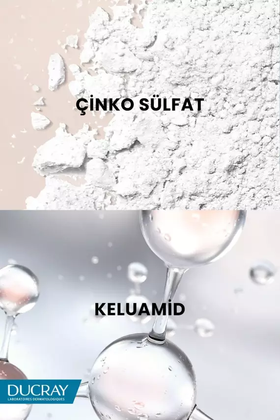 Ducray Kelual Squanorm Kepek Önleyici ve Kaşıntı Hissini Yatıştırıcı Losyon 200 ml - 2